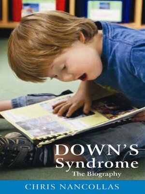 cover image of Down's Syndrome